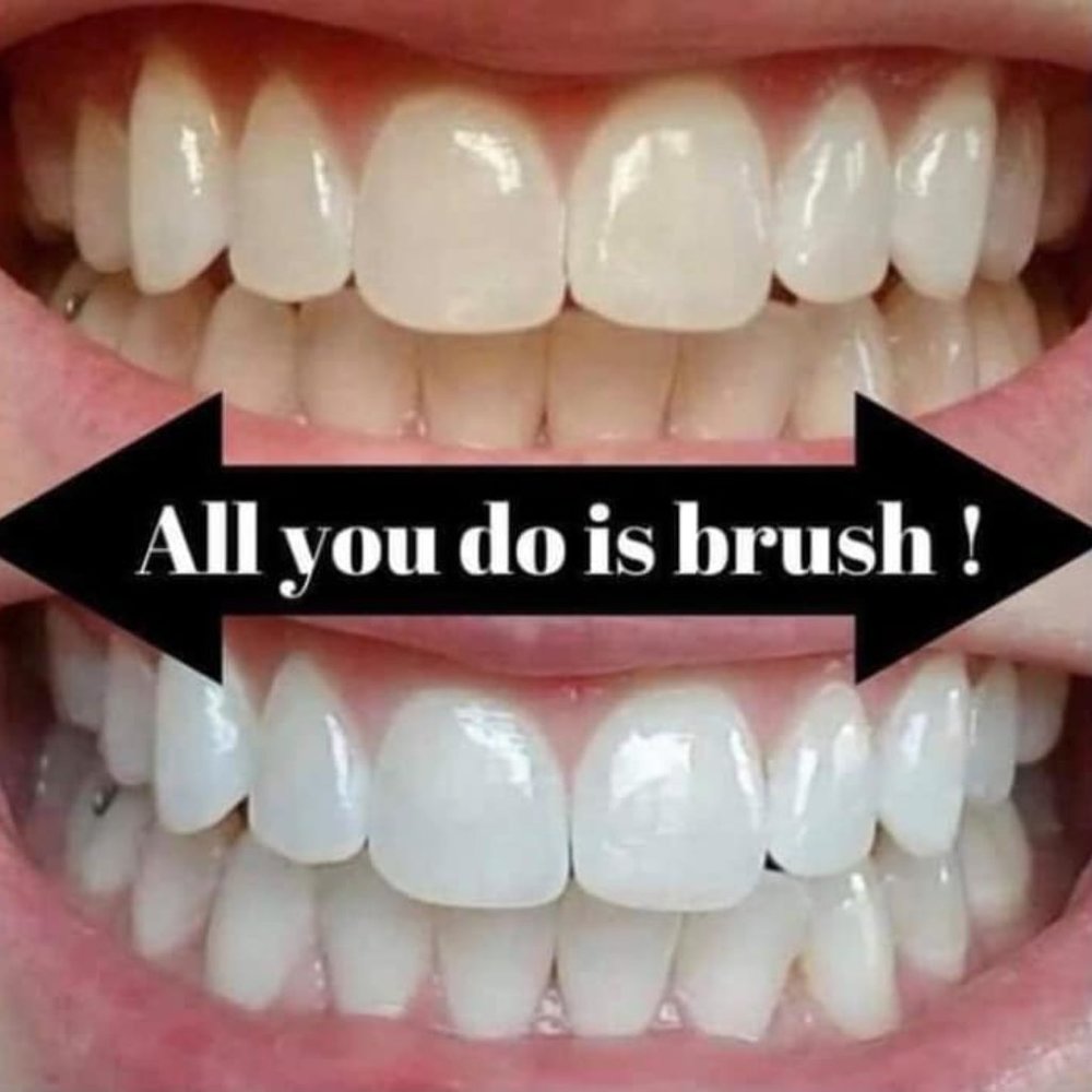 Tooth paste Whitener